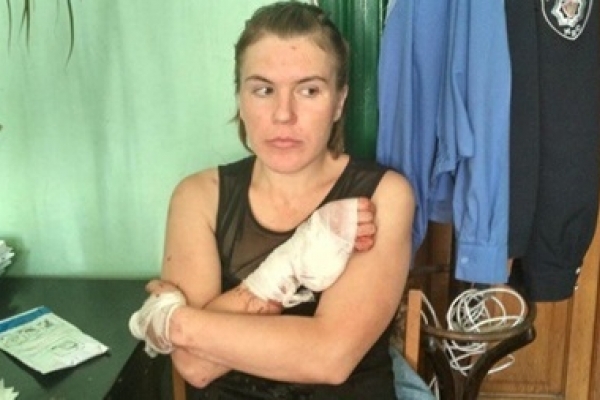 Росіянка, яка облила кислотою співробітницю РАГСу у Львові, сяде за грати
