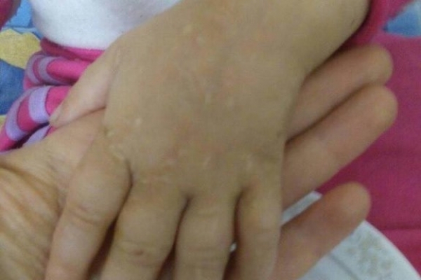 Після побоїв матері на Львівщині госпіталізували 4-річну дівчинку (Фото)