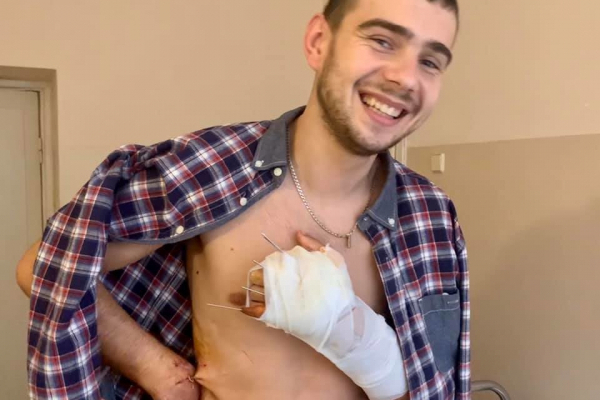 У Львові хірурги лікарні ШМД пришили 23-річному хлопцеві відірвану руку