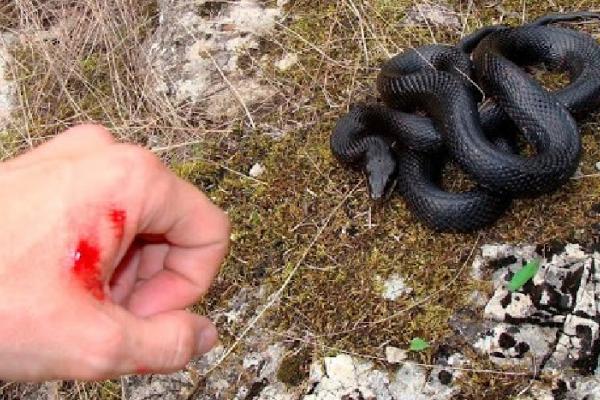 На Львівщині 21-річного хлопця покусала змія