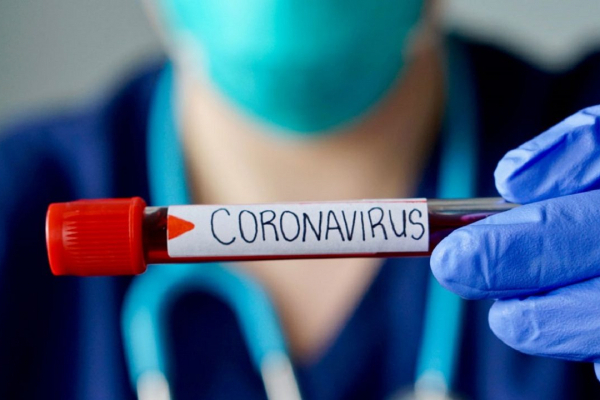 На Львівщині за добу до лікарень потрапило 75 пацієнтів з COVID-19