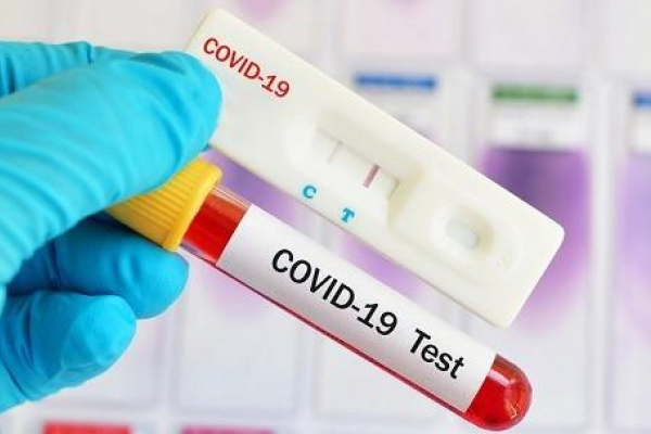 Коронавірус на Прикарпатті: за добу зафіксовано 1121 новий випадок COVID-19