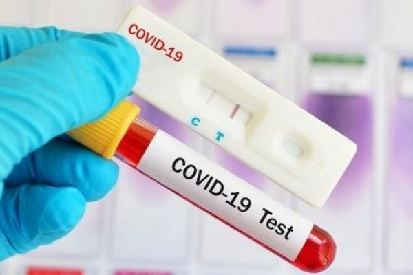 На Львівщині зростає захворюваність COVID-19