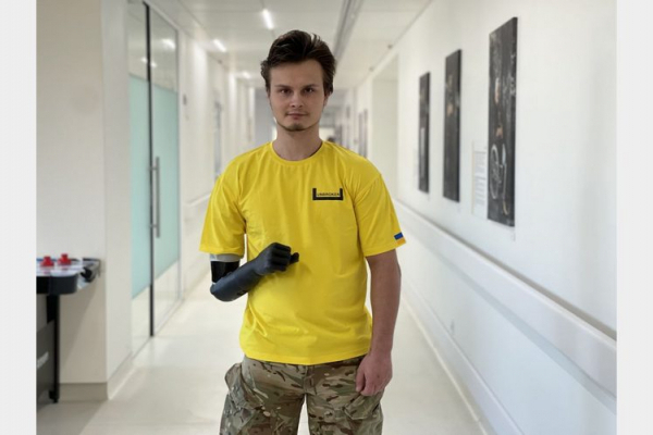 22-річний захисник отримав біонічну руку у Львові