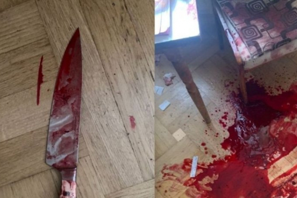 На Львівщині 44-річного сина, який зарізав ножем 79-річного батька, взяли під варту